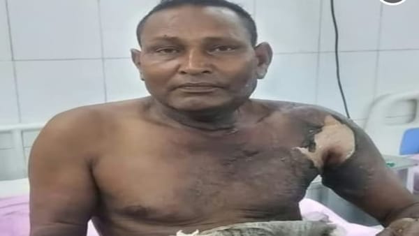 जिंदा जलाने की कोशिश, पुलिस की गिरफ्त में पूर्व प्रधान का बेटा.!